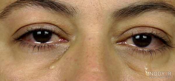 عکس پروفایل چشم گریان طبیعی غمگین - ژاویز عکس پروفایل چشم گریان طبیعی غمگین - ژاویز