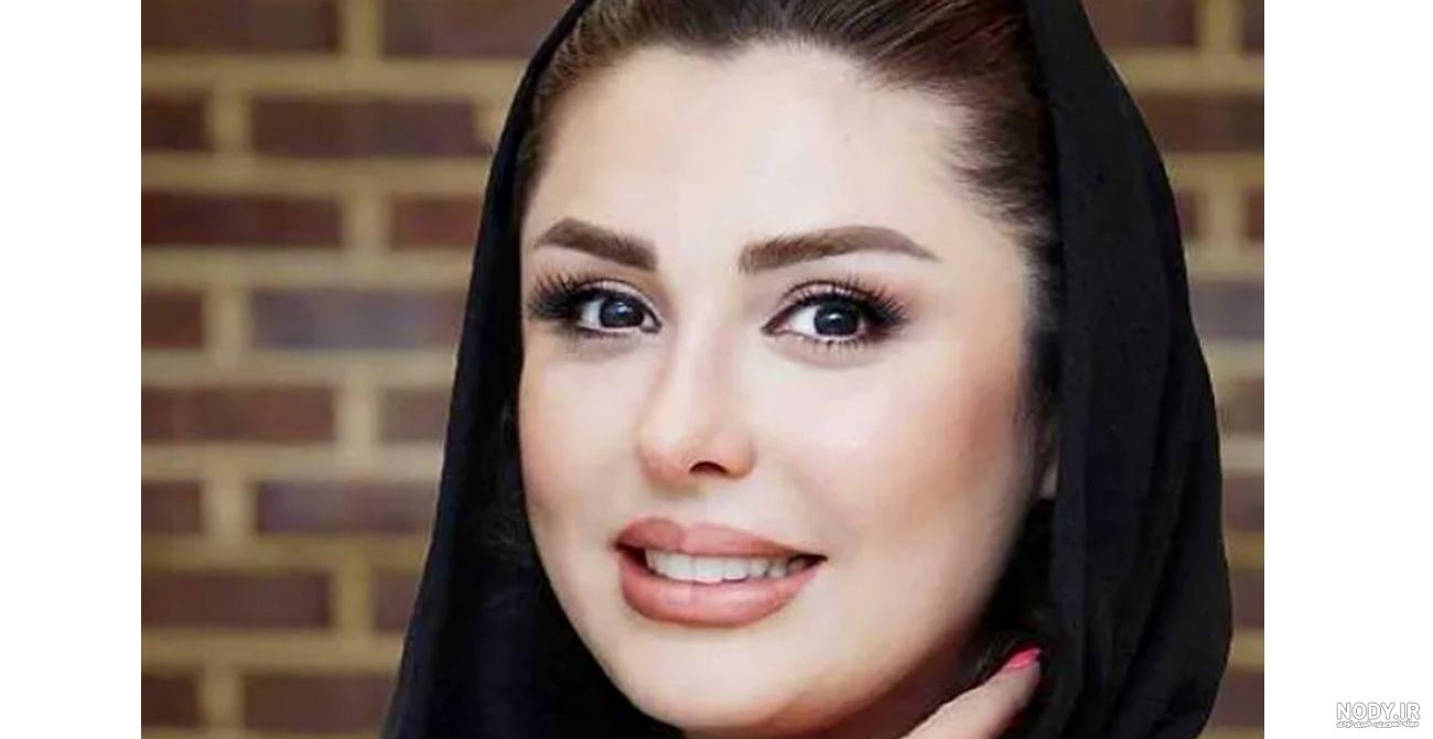 نیوشا ضیغمی در چاق ترین حالت ممکن بعد از عمل ! | عکس لورفته عروسی ... نیوشا ضیغمی در چاق ترین حالت ممکن بعد از عمل ! | عکس لورفته عروسی ...