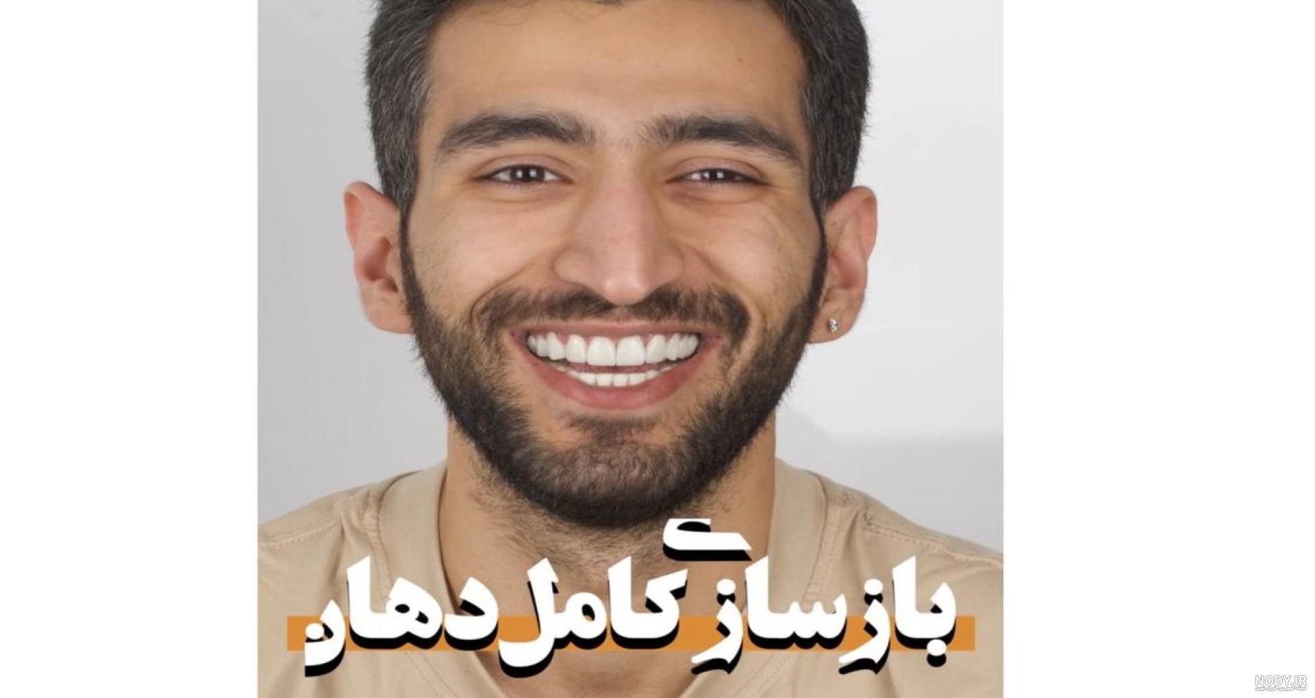 آموزش ساخت ماشین تویوتا پرادو از چوب آموزش ساخت ماشین تویوتا پرادو از چوب