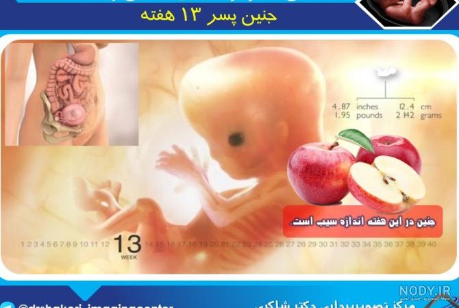 عکس جنین پسر در 20 هفتگی - عکس نودی