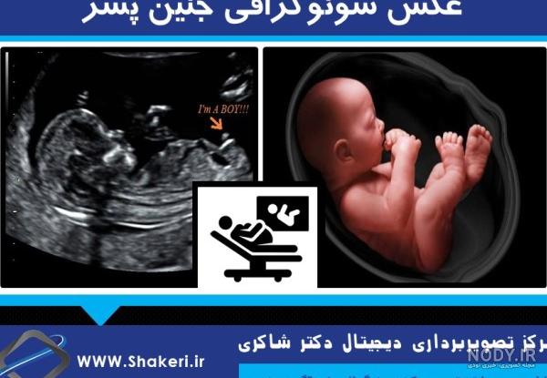 عکس واقعی جنین بیست هفته