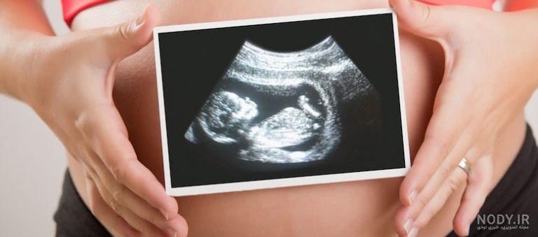 هفته بیستم بارداری جنین دختر و پسر | سونوگرافی و تغذیه هفته 20