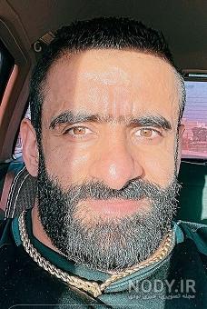 عکس صورت هادی چوپان