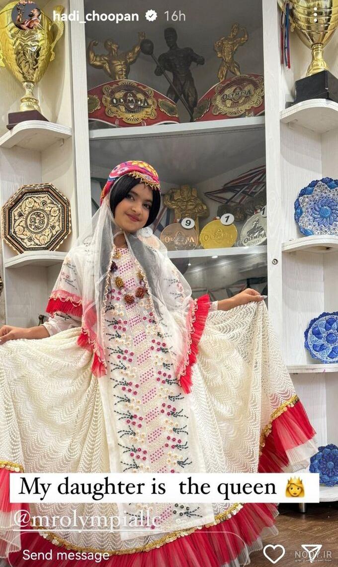 هادی چوپان ژست فضایی گرفت +عکس