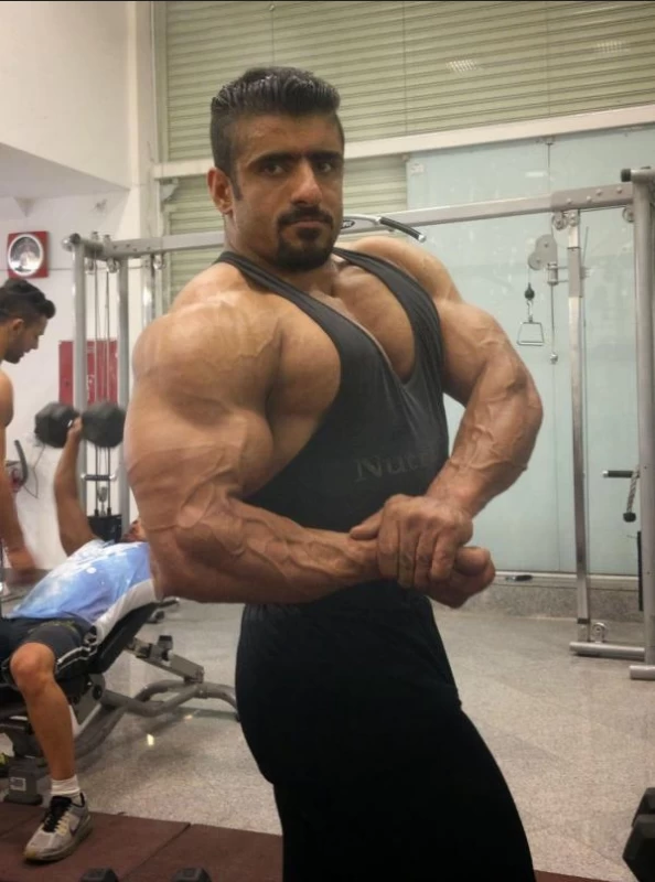 باورتون میشه چهره واقعی هادی چوپان قبل از قهرمانی این شکلی بوده ؟!