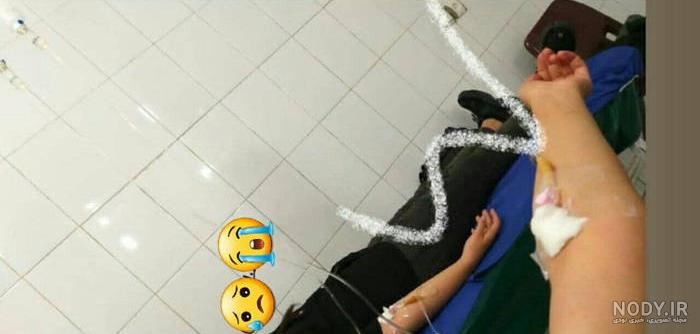 عکس دسته شکسته گچ گرفته دختر - عکس نودی