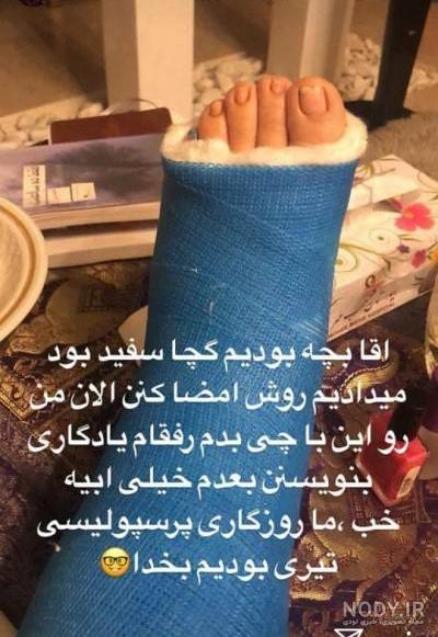 عکس فیک پای شکسته دختر