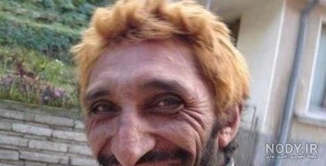 عکس پسر زشت سیاه