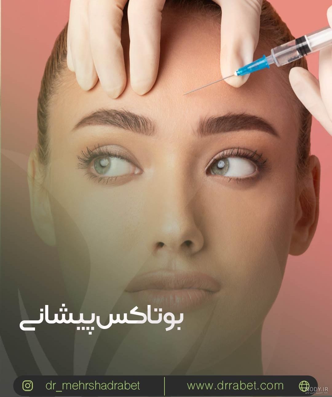 عکس پیشانی بوتاکس شده