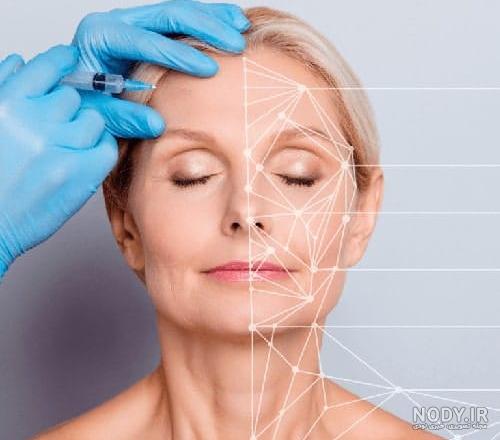 نمونه تزریق بوتاکس: نمونه های واقعی تزریق بوتاکس پیشانی، خط اخم و ...