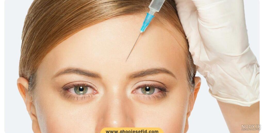 نمونه تزریق بوتاکس: نمونه های واقعی تزریق بوتاکس پیشانی، خط اخم و ...