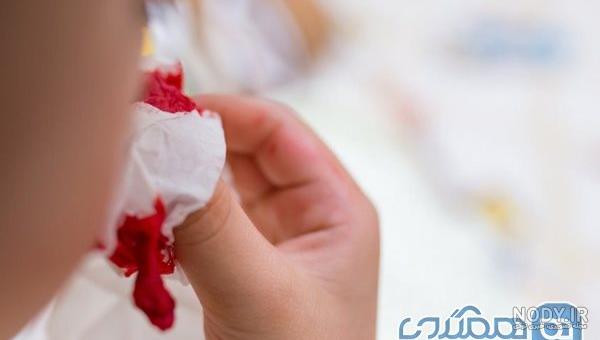 عکس فیک تیغ زده دخترانه عکس فیک تیغ زده دخترانه