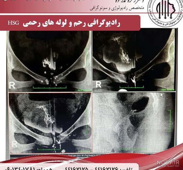 آنچه در مورد عکس رنگی رحم باید بدانید آنچه در مورد عکس رنگی رحم باید بدانید