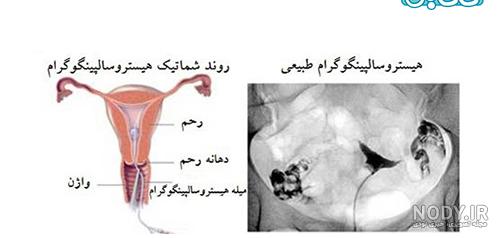 عوارض بعد از عکس رنگی رحم چیست و به چه علت بروز می کند؟ | نی نی پلاس عوارض بعد از عکس رنگی رحم چیست و به چه علت بروز می کند؟ | نی نی پلاس