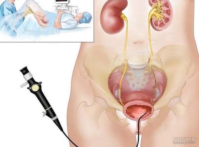 عوارض عکس رنگی رحم نی نی سایت عوارض عکس رنگی رحم نی نی سایت