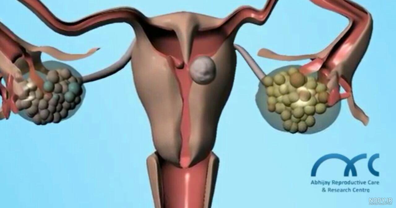 عکس رنگی چجوریه نی نی سایت - عکس نودی عکس رنگی چجوریه نی نی سایت - عکس نودی