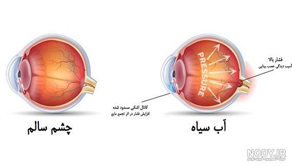 عکس از آب سیاه چشم عکس از آب سیاه چشم