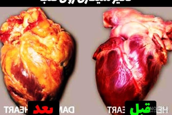 عکس در مورد ضرر سیگار