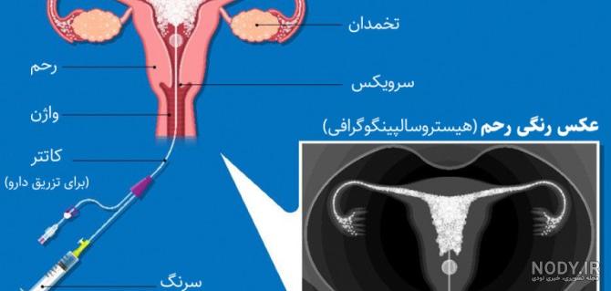 عکس در مورد ضرر سیگار