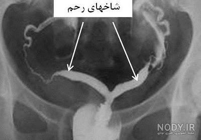 عکس نوشته طنز سیگار