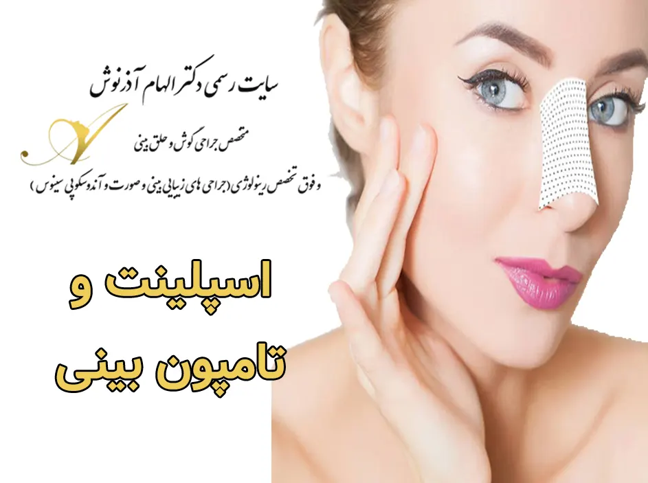 اسپلینت داخل بینی (تامپون سیلیکونی بینی) - شرکت آسیا جراح پیشرو اسپلینت داخل بینی (تامپون سیلیکونی بینی) - شرکت آسیا جراح پیشرو
