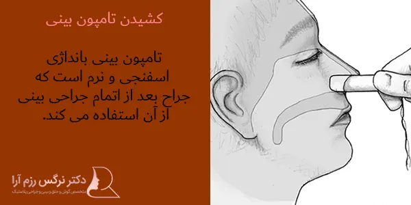 تامپون بینی چیست | مراقبت ها و نحوه برداشت - دکتر فرشته عبدالمطلبی تامپون بینی چیست | مراقبت ها و نحوه برداشت - دکتر فرشته عبدالمطلبی