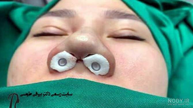 تامپون بینی چیست و چه کاربردی دارد؟ | دکتر خسرو مقتدر تامپون بینی چیست و چه کاربردی دارد؟ | دکتر خسرو مقتدر