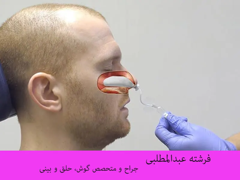 تامپون بینی چیست؟ - آیا برداشتن تامپون بینی درد دارد؟ - drmattab تامپون بینی چیست؟ - آیا برداشتن تامپون بینی درد دارد؟ - drmattab