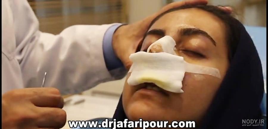 تامپون بینی چیست؟ دلایل استفاده از تامپون بینی تامپون بینی چیست؟ دلایل استفاده از تامپون بینی