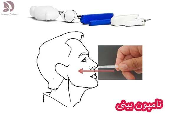 تامپون در جراحی بینی + تامپون خوب است یا بد؟؟ دکتر علیرضا مجلسی تامپون در جراحی بینی + تامپون خوب است یا بد؟؟ دکتر علیرضا مجلسی