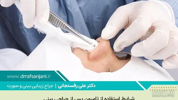 فیلم کشیدن تامپون فیلم کشیدن تامپون