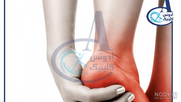 قیمت کفش مخصوص خار پاشنه چقدر است؟⭐با بهترین کیفیت و ضمانت قیمت کفش مخصوص خار پاشنه چقدر است؟⭐با بهترین کیفیت و ضمانت