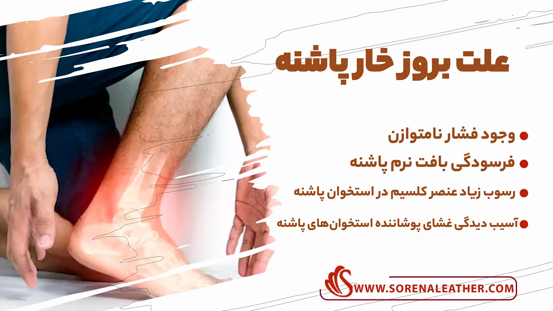 کفش مناسب خار پاشنه چه ویژگی هایی دارد؟ | چرم سورنا کفش مناسب خار پاشنه چه ویژگی هایی دارد؟ | چرم سورنا
