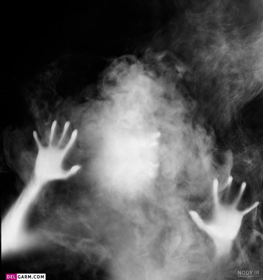  عکس خون آشام برای پروفایل پسرانه