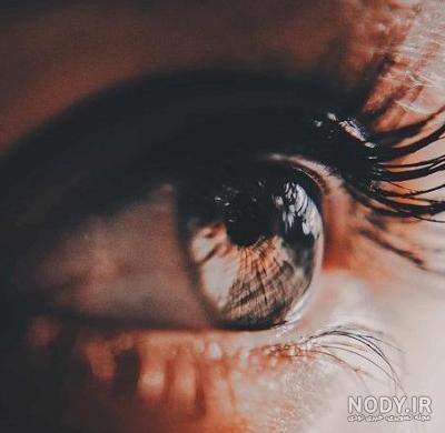 عکس دختر یک چشم در اصفهان - عکس نودی