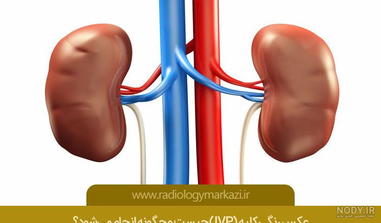 عکس ساده از کلیه عکس ساده از کلیه