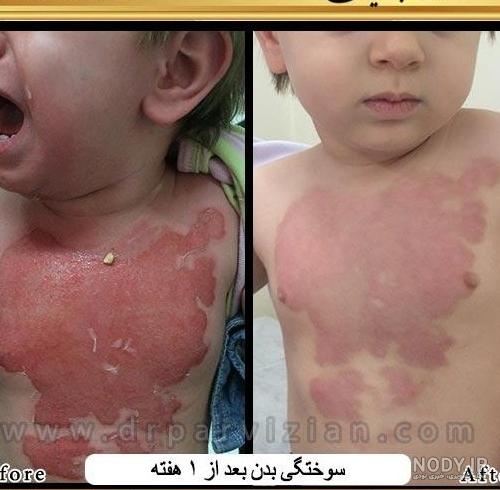 آموزش گریم و نقاشی روی صورت کودکان| آموزش کودک| تفریح کودک| آموزش بانوان
