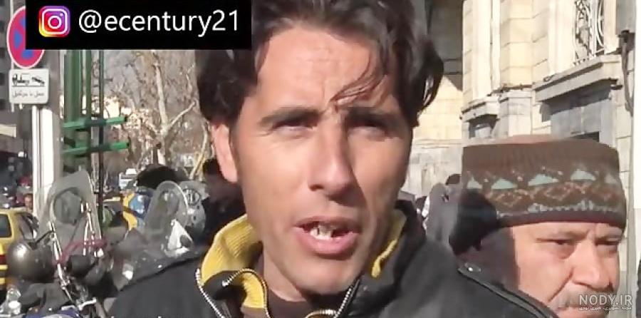 عکس های قبل از عمل سحر تبر | سوژه شدن سحر تبر در رسانه های خارجی عکس های قبل از عمل سحر تبر | سوژه شدن سحر تبر در رسانه های خارجی