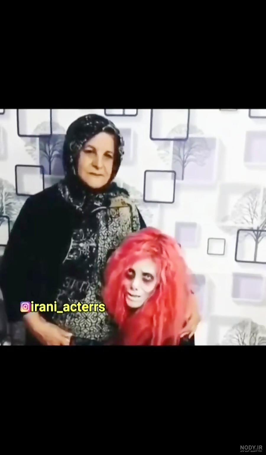 عکس های قبل از عمل سحر تبر | سوژه شدن سحر تبر در رسانه های خارجی عکس های قبل از عمل سحر تبر | سوژه شدن سحر تبر در رسانه های خارجی