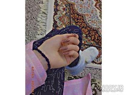 عکس فیک شکستن پا - عکس نودی