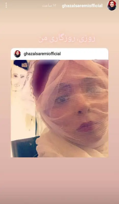 زیباترین عکس های غزل صارمی · جدید ۱۴۰۳ -❤️ گهر