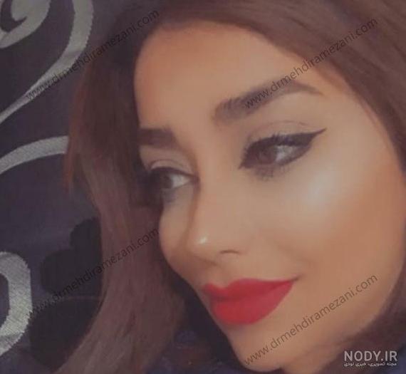 عکس خفن دختران فشن با بینی عمل کرده در اینترنت