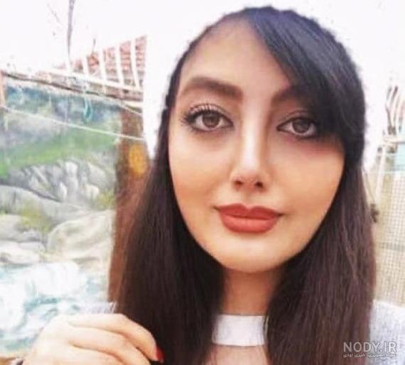 عکس دختر بعد از عمل بینی