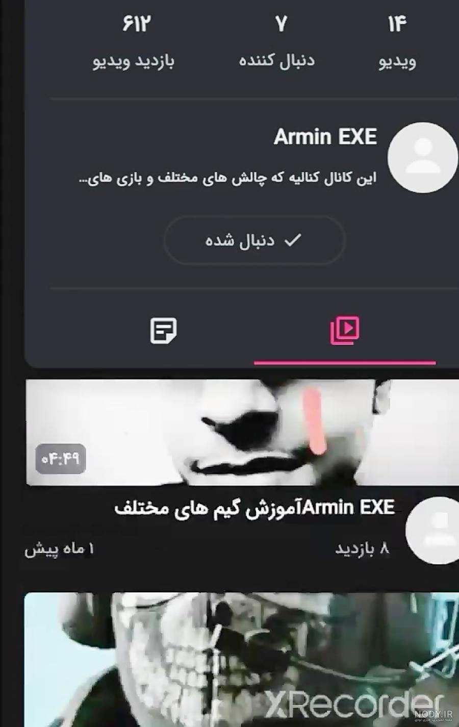 عکس های قبل عمل دیانا رحیمی