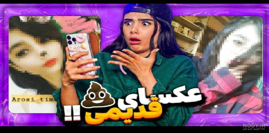 عکس قبل عمل دیانا رحیمی - عکس نودی