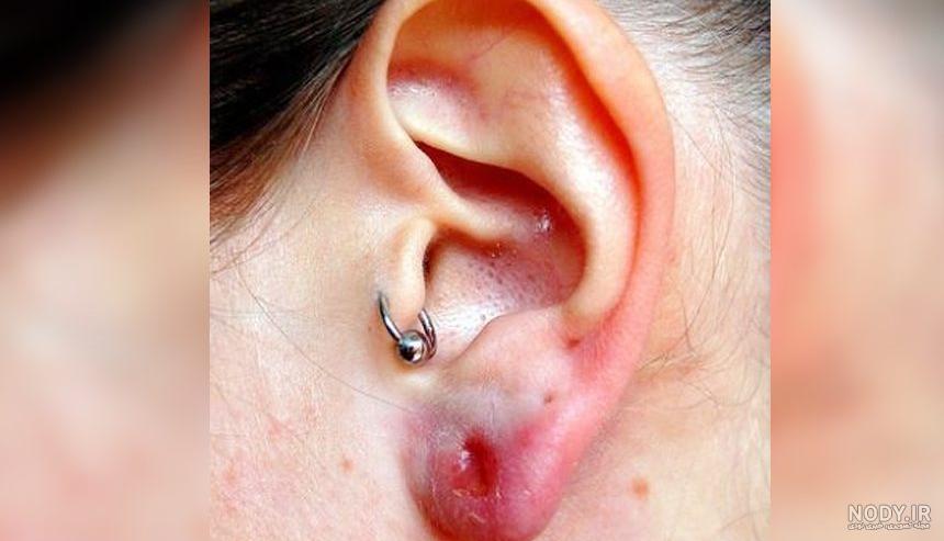 پیرسینگ ناف (Navel Piercing) چیست و چگونه انجام می‌شود؟