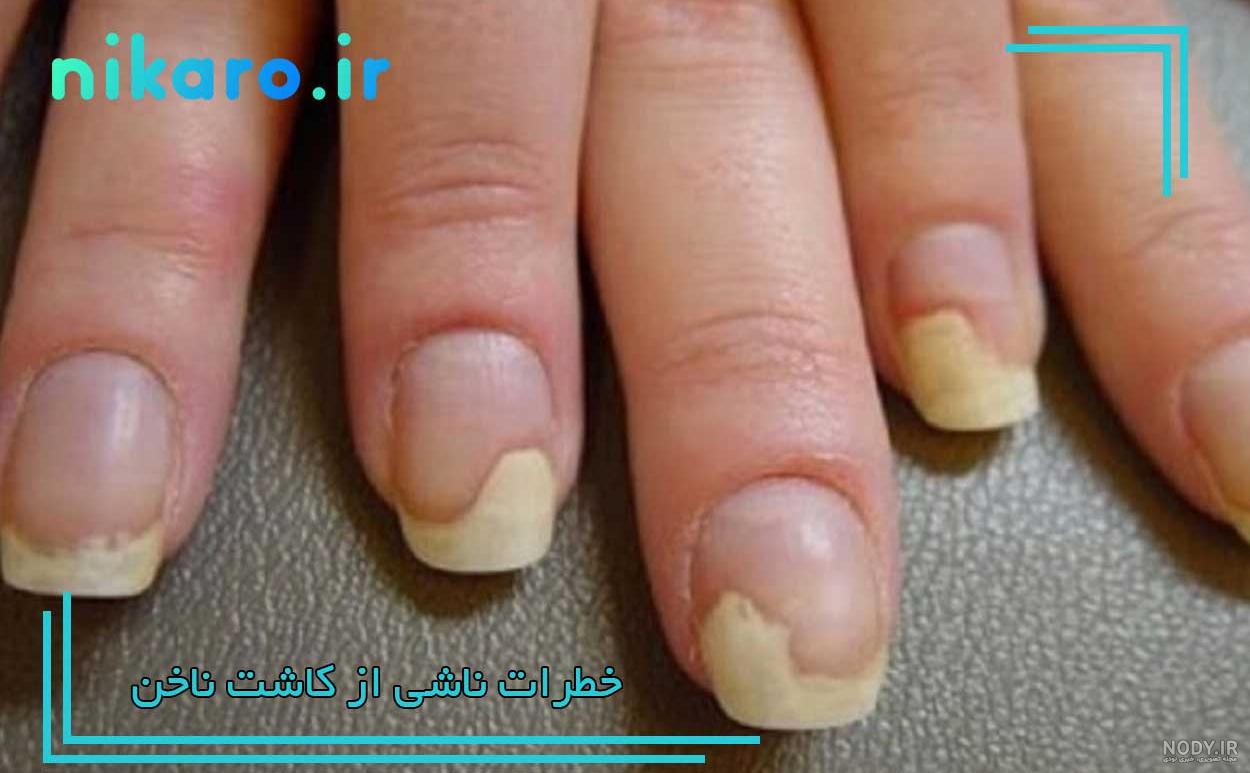 عکس کاشت ناخن با ژل عکس کاشت ناخن با ژل