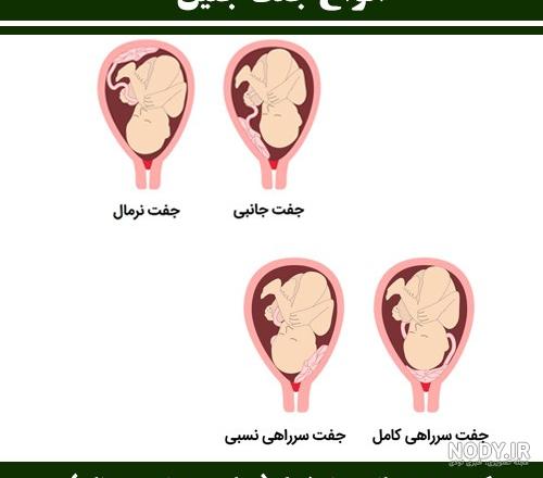 فریز تخمک بهتر است یا فریز جنین/ عکس جنین فریز شده سه روزه