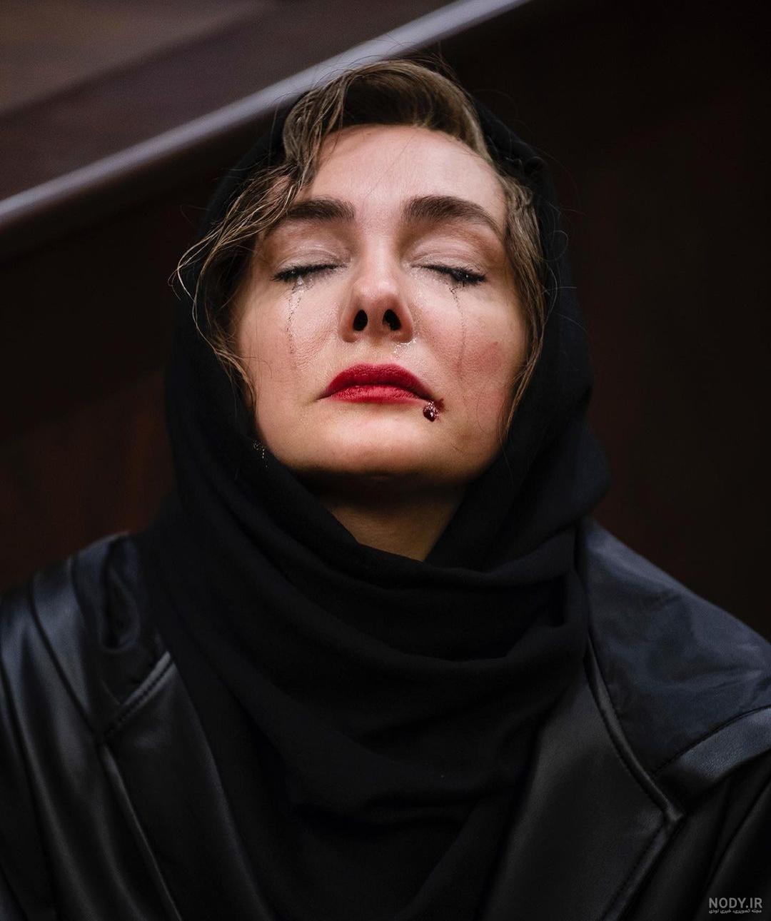 عکس هانیه توسلی بعد از شیمی درمانی عکس هانیه توسلی بعد از شیمی درمانی