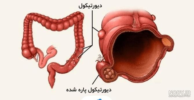 آناتومی شکم انسان چیست؟ تشخیص انواع بیماری‌های شکمی